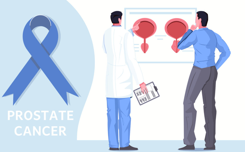 prostate cancer expert Rohini Delhi