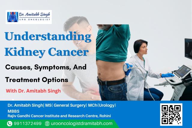 kidney cancer specialist west delhi